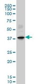 Monoclonal Anti-LHX6 antibody produced in mouse clone 3D9, purified immunoglobulin, buffered aqueous solution