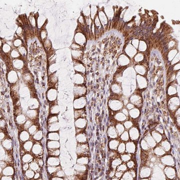 Anti-CLPB antibody produced in rabbit Prestige Antibodies&#174; Powered by Atlas Antibodies, affinity isolated antibody, buffered aqueous glycerol solution