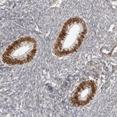 Anti-NUP153 antibody produced in rabbit Prestige Antibodies® Powered by Atlas Antibodies, affinity isolated antibody, buffered aqueous glycerol solution, ab1