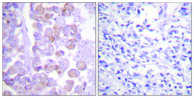 Anti-Synuclein antibody produced in rabbit affinity isolated antibody