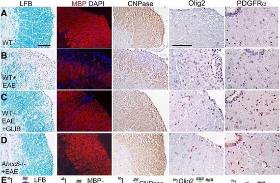 Anti-Olig2 Antibody, clone 211F1.1 clone 211F1.1, from mouse