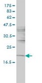 Monoclonal Anti-NIFUN antibody produced in mouse clone 3B8-1C4, purified immunoglobulin, buffered aqueous solution