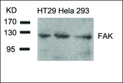 Anti-PTK2 (Ab-861) antibody produced in rabbit affinity isolated antibody