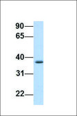 Anti-SRRD antibody produced in rabbit affinity isolated antibody