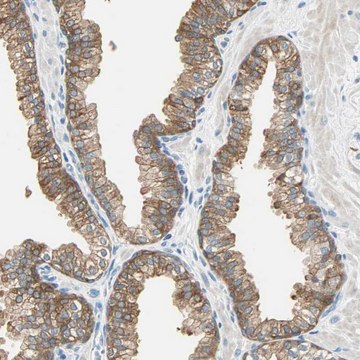 Anti-ATF6 antibody produced in rabbit Prestige Antibodies&#174; Powered by Atlas Antibodies, affinity isolated antibody, buffered aqueous glycerol solution