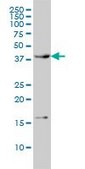 Monoclonal Anti-CAMK1 antibody produced in mouse clone 3G1, purified immunoglobulin, buffered aqueous solution