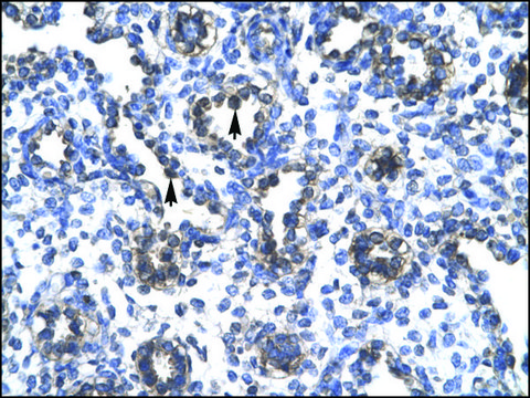 Anti-FOXA3 affinity isolated antibody