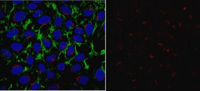 Anti-PFKFB3 Antibody, clone 4C10.2 clone 4C10.2, from mouse