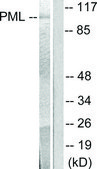 Anti-PML antibody produced in rabbit affinity isolated antibody