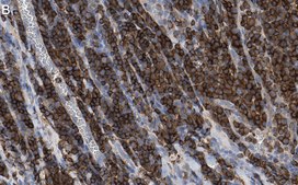 Anti-Cofilin-1 Antibody, clone 1C18 ZooMAb® Rabbit Monoclonal recombinant, expressed in HEK 293 cells