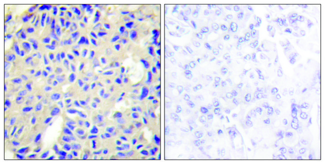 Anti-Collagen V &#945;2 antibody produced in rabbit affinity isolated antibody