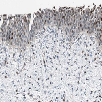 Anti-RAD1 antibody produced in rabbit Prestige Antibodies&#174; Powered by Atlas Antibodies, affinity isolated antibody, buffered aqueous glycerol solution