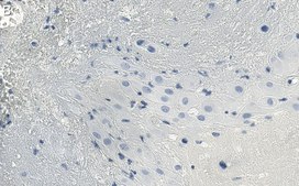 Anti-HDAC7 Antibody, clone 1L17 ZooMAb® Rabbit Monoclonal recombinant, expressed in HEK 293 cells