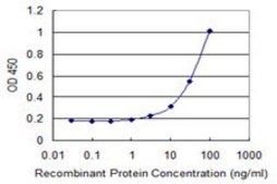 Monoclonal Anti-SLC27A2 antibody produced in mouse clone 1F1, purified immunoglobulin, buffered aqueous solution