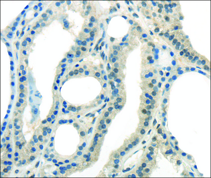 Anti-ENTPD1 affinity isolated antibody