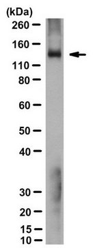 Anti-Adenylate Cyclase 5 Antibody, clone 19D5.C1 clone 19D5.C1, from mouse