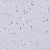 Anti-CD7 antibody produced in rabbit Prestige Antibodies® Powered by Atlas Antibodies, affinity isolated antibody, buffered aqueous glycerol solution