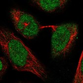 Anti-POLR3C antibody produced in rabbit Prestige Antibodies® Powered by Atlas Antibodies, affinity isolated antibody, buffered aqueous glycerol solution, ab1