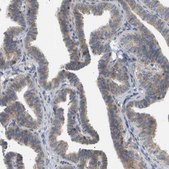 Anti-CORO2B antibody produced in rabbit Prestige Antibodies® Powered by Atlas Antibodies, affinity isolated antibody, buffered aqueous glycerol solution