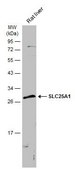 Anti-SLC25A1 antibody produced in rabbit affinity isolated antibody, buffered aqueous solution