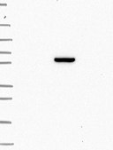 Anti-ANKRD55 antibody produced in rabbit Prestige Antibodies® Powered by Atlas Antibodies, affinity isolated antibody, buffered aqueous glycerol solution