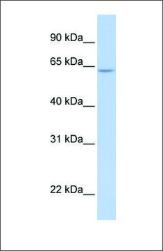 Anti-ARID5A (ab1) antibody produced in rabbit affinity isolated antibody