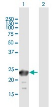 Anti-SSX6 antibody produced in mouse purified immunoglobulin