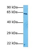 Anti-METTL3 (AB1) antibody produced in rabbit IgG fraction of antiserum