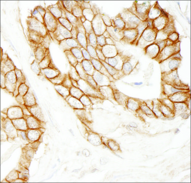 Rabbit anti-Beta-catenin Antibody, Affinity Purified Powered by Bethyl Laboratories, Inc.