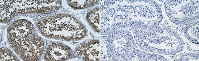 Anti-DRP1 Antibody, clone 1E8 ZooMAb&#174; Rabbit Monoclonal recombinant, expressed in HEK 293 cells