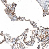 Monoclonal Anti-AGER antibody produced in mouse Prestige Antibodies® Powered by Atlas Antibodies, clone CL10587, purified antibody (Protein A)