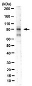 Anti-MRE11 Antibody, clone 15B8.1E7.6 clone 15B8.1E7.6, from hamster(Armenian)
