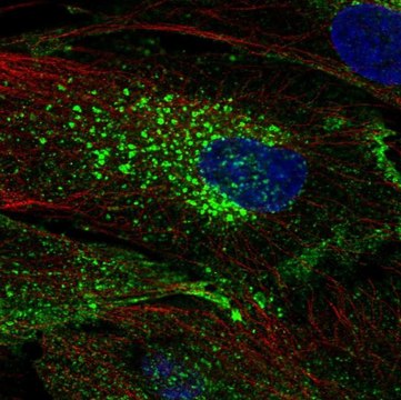 Anti-CHIC2 antibody produced in rabbit Prestige Antibodies&#174; Powered by Atlas Antibodies, affinity isolated antibody