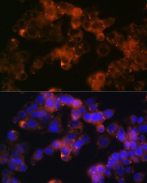 Anti-Sonic Hedgehog (Shh) antibody produced in rabbit