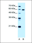 Anti-TBX15 antibody produced in rabbit IgG fraction of antiserum