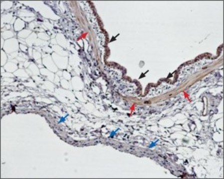 Anti-Endothelin Receptor B antibody produced in rabbit affinity isolated antibody, lyophilized powder