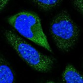 Anti-CNTN5 antibody produced in rabbit Prestige Antibodies® Powered by Atlas Antibodies, affinity isolated antibody, buffered aqueous glycerol solution