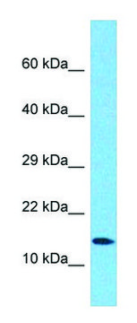 Anti-ATP5F1D antibody produced in rabbit affinity isolated antibody