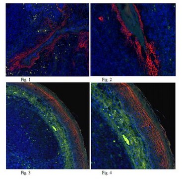 Anti-Desmoglein-1 Antibody, clone 32-2B clone 32-2B, from mouse