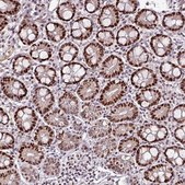 Anti-KLF16 antibody produced in rabbit Prestige Antibodies® Powered by Atlas Antibodies, affinity isolated antibody, buffered aqueous glycerol solution