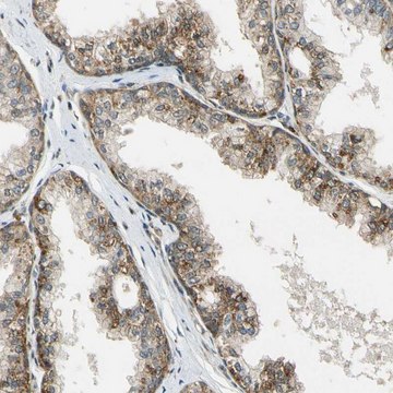 ANTI-LAMTOR1 antibody produced in rabbit Prestige Antibodies&#174; Powered by Atlas Antibodies, affinity isolated antibody, buffered aqueous glycerol solution