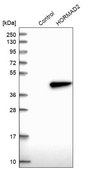 Anti-HORMAD2 antibody produced in rabbit Prestige Antibodies® Powered by Atlas Antibodies, affinity isolated antibody, buffered aqueous glycerol solution