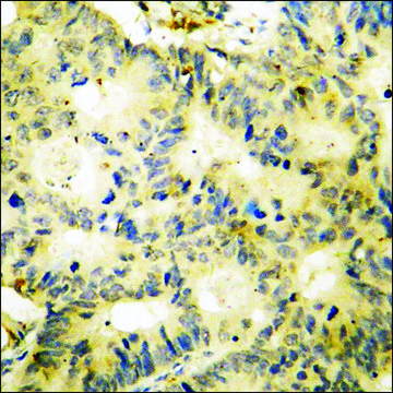 Anti-phospho-SYK (pTyr348) antibody produced in rabbit affinity isolated antibody