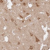 Anti-ATP8A1 antibody produced in rabbit Prestige Antibodies® Powered by Atlas Antibodies, affinity isolated antibody, buffered aqueous glycerol solution