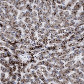 Anti-ACOX1 antibody produced in rabbit Prestige Antibodies® Powered by Atlas Antibodies, affinity isolated antibody, buffered aqueous glycerol solution, Ab2