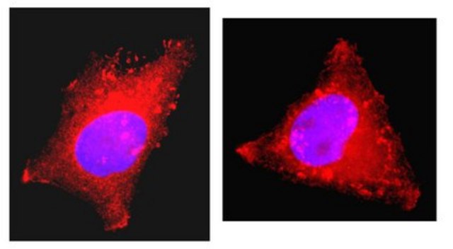 Anti-Cortactin (p80/85) Antibody, clone 4F11, Alexa Fluor&#8482; 555 clone 4F11, Upstate&#174;, from mouse