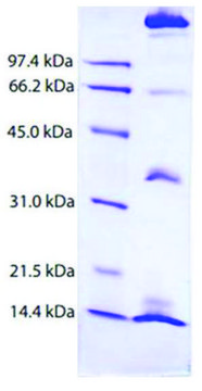 Chylomicrons from human plasma &#8805;95% (SDS-PAGE)