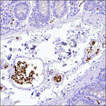 Anti-LY6G6D antibody produced in rabbit Prestige Antibodies&#174; Powered by Atlas Antibodies, affinity isolated antibody, buffered aqueous glycerol solution