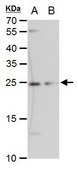 Monoclonal Anti-ETHE1 antibody produced in mouse clone GT1621, affinity isolated antibody