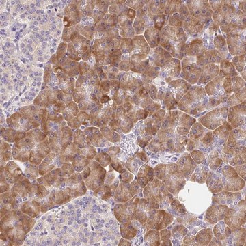 Anti-RPL18A antibody produced in rabbit Prestige Antibodies&#174; Powered by Atlas Antibodies, affinity isolated antibody, buffered aqueous glycerol solution